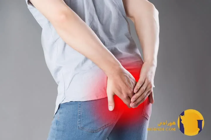 علائم بواسیر و درمان بدون جراحی