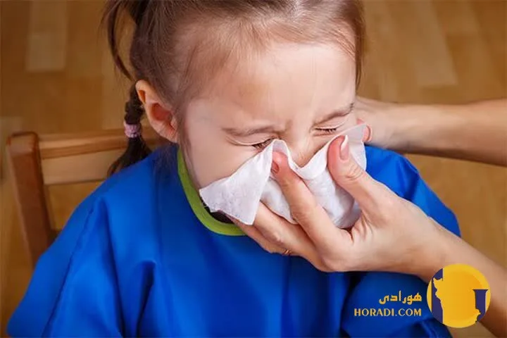 درمان سریع آبریزش بینی و آلرژی فصلی