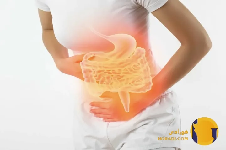 علائم سندروم روده تحریک پذیر و درمان آن