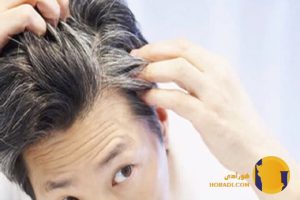 چگونه موهای سفید را به تأخیر بیندازیم؟
