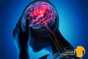 سکته مغزی چیست؟ علل علائم تشخیص و درمان ایسکمی مغزی