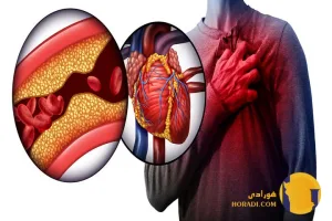 حمله قلبی چیست؟ علائم پیشگیری و درمان اورژانسی