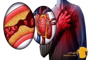 حمله قلبی چیست؟ علائم پیشگیری و درمان اورژانسی