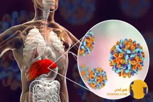 هپاتیت B چیست؟ علائم انتقال و درمان