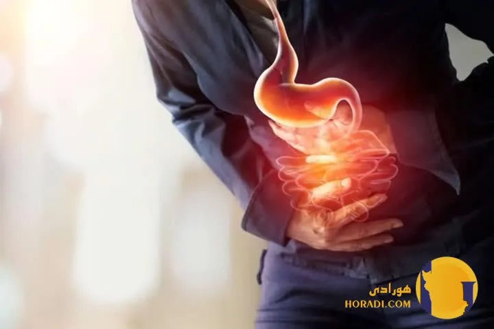 رفلاکس معده چیست؟ علائم علت ها و روش های کنترل
