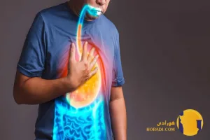 رفلاکس معده چیست؟ علائم علت ها و روش های کنترل