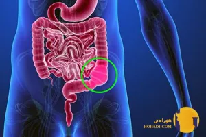 یبوست چیست؟ علائم علت ها و روش های رفع