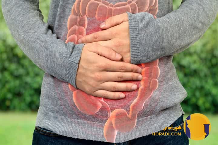 یبوست چیست؟ علائم علت ها و روش های رفع