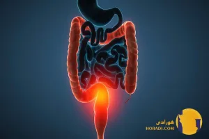 کولیت چیست؟ علائم انواع و درمان