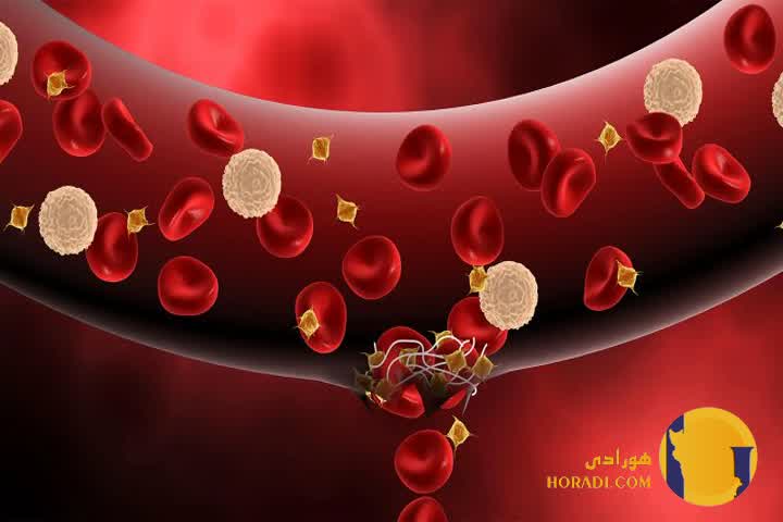 هموفیلی چیست؟ علائم و روش های کنترل خونریزی