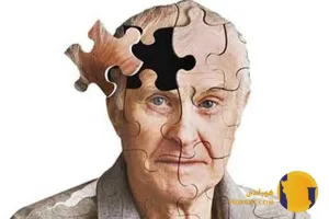آلزایمر چیست؟ علائم تشخیص و روش های مراقبت