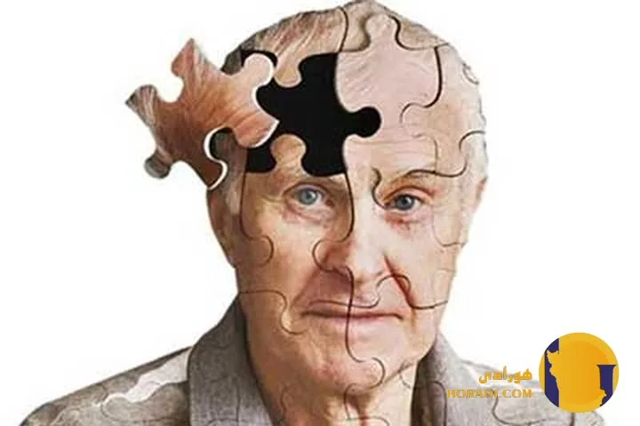 آلزایمر چیست؟ علائم تشخیص و روش های مراقبت