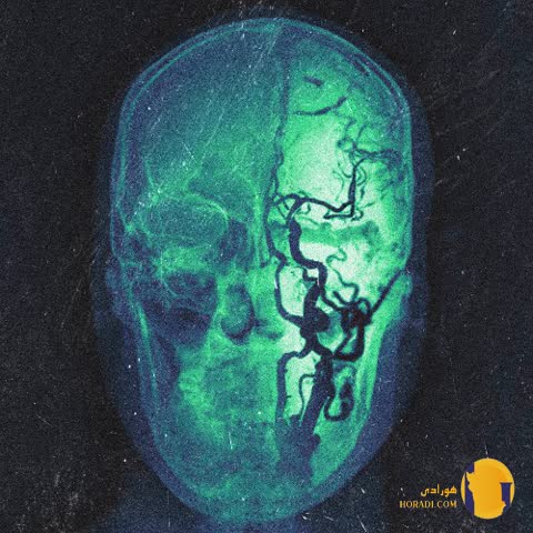 دانلود اهنگ سردرد فرزاد قدیمی + متن اهنگ