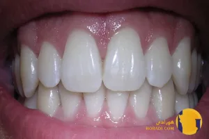 مشکلات دندان و لثه چیست؟ علائم و درمان