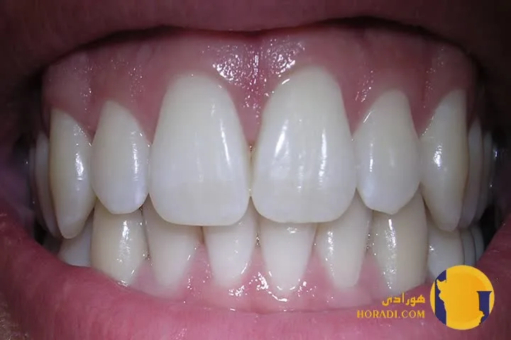 مشکلات دندان و لثه چیست؟ علائم و درمان