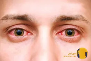 اقدامات اورژانسی برای برق زدگی در منزل