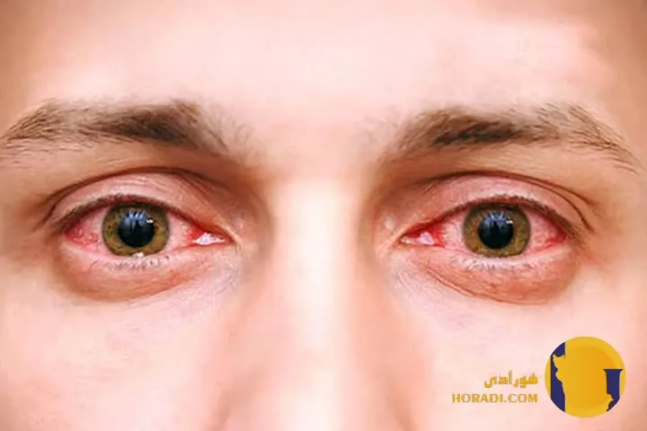 اقدامات اورژانسی برای برق زدگی در منزل