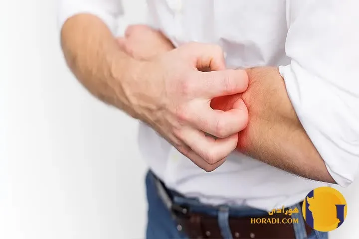 کمک فوری در حمله آلرژیک شدید (آنافیلاکسی)