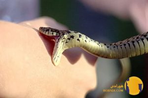 کمک فوری در گزش مار و عقرب
