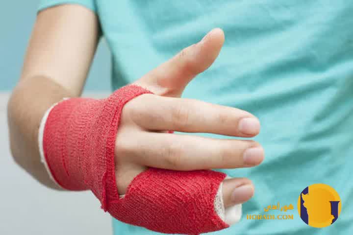 کمک های اولیه در شکستگی انگشت و دست