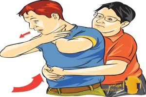 اقدامات اورژانسی در خفگی ناشی از مواد غذایی