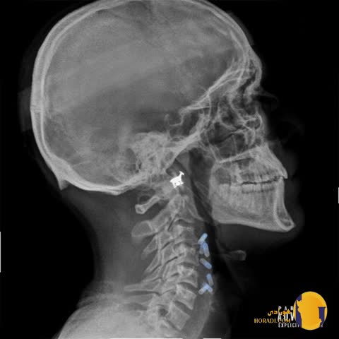 دانلود آهنگ سوگند هیپهاپولوژیست + متن آهنگ