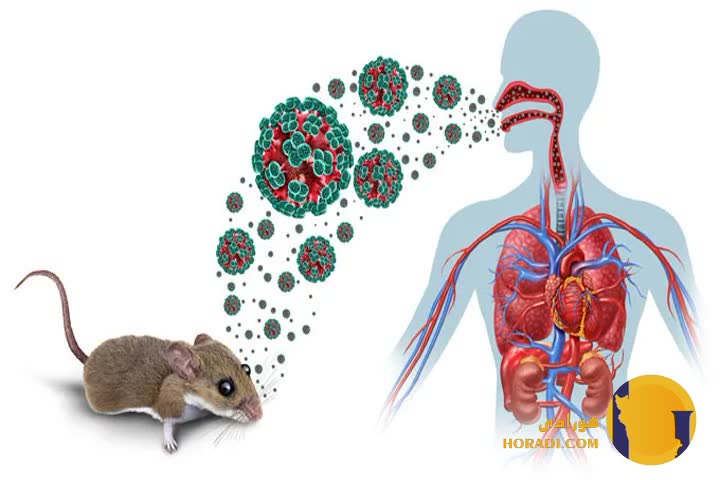 هانتاویروس (Hantavirus infection)